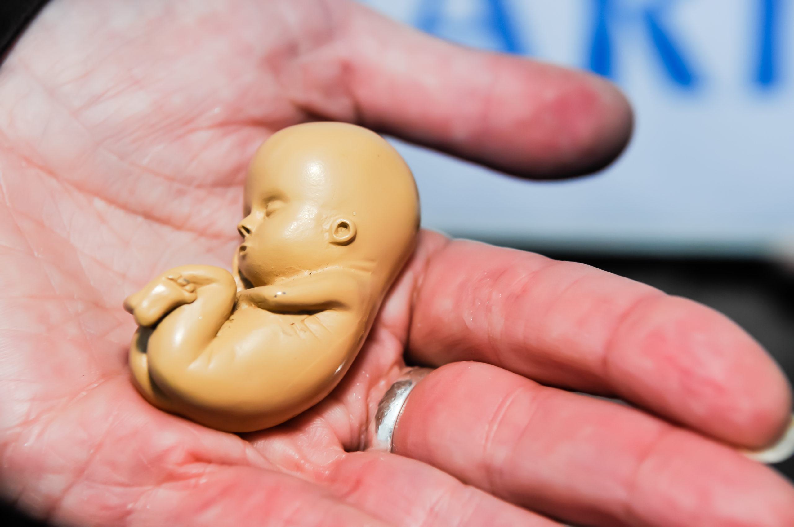 Drie dodelijke dubbelzinnigheden van de abortuswet