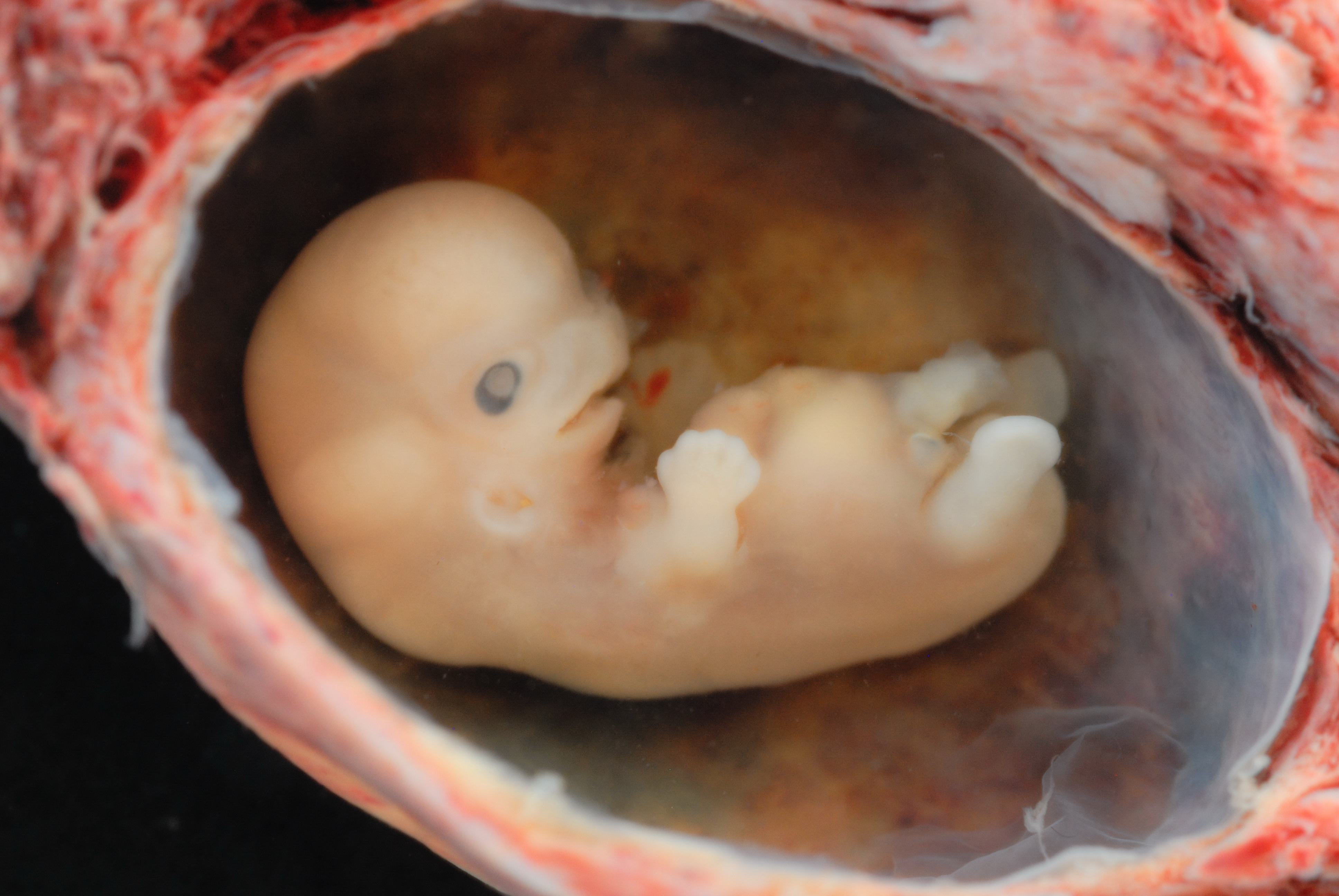 Experimenteren met embryo's? Ethisch onverantwoord