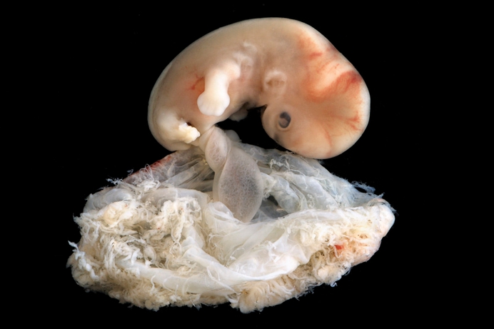Waarom maakt "Baby Olivia" de abortusvoorstanders zo bang?