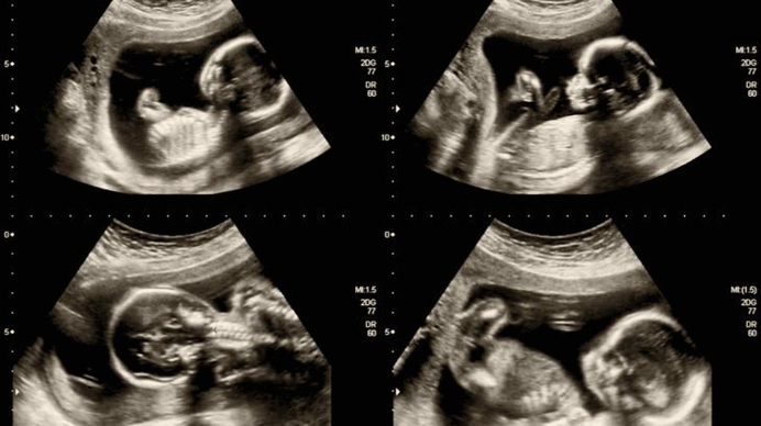 Laatste abortuscijfers: coronacrisis brengt geen daling