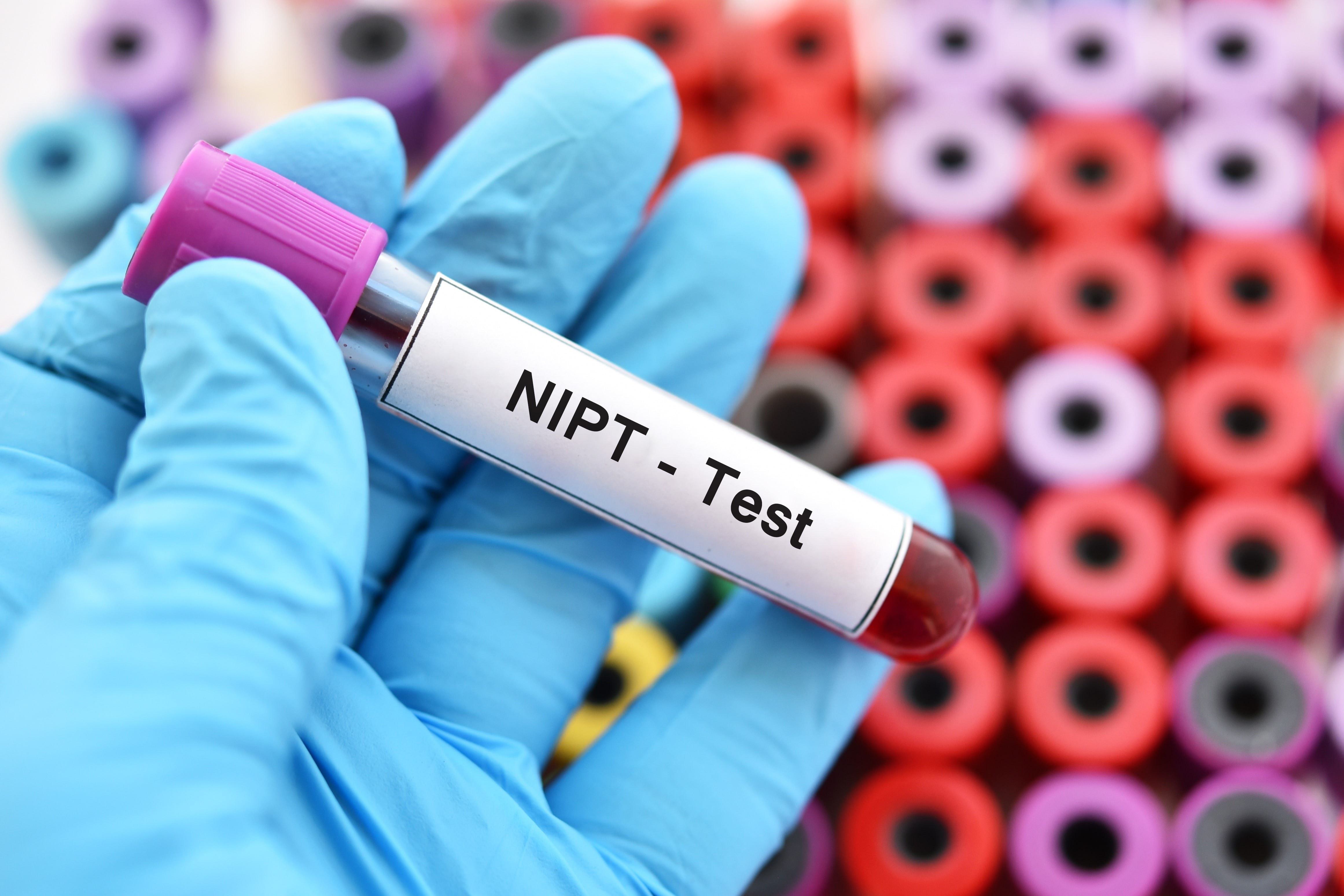 Wat je niet mag weten over NIPT