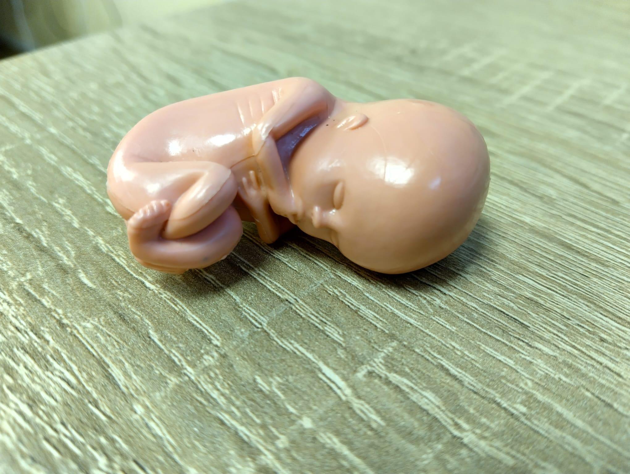Positieve reacties op pro-life poppetje tonen kentering publieke opinie aan over abortus