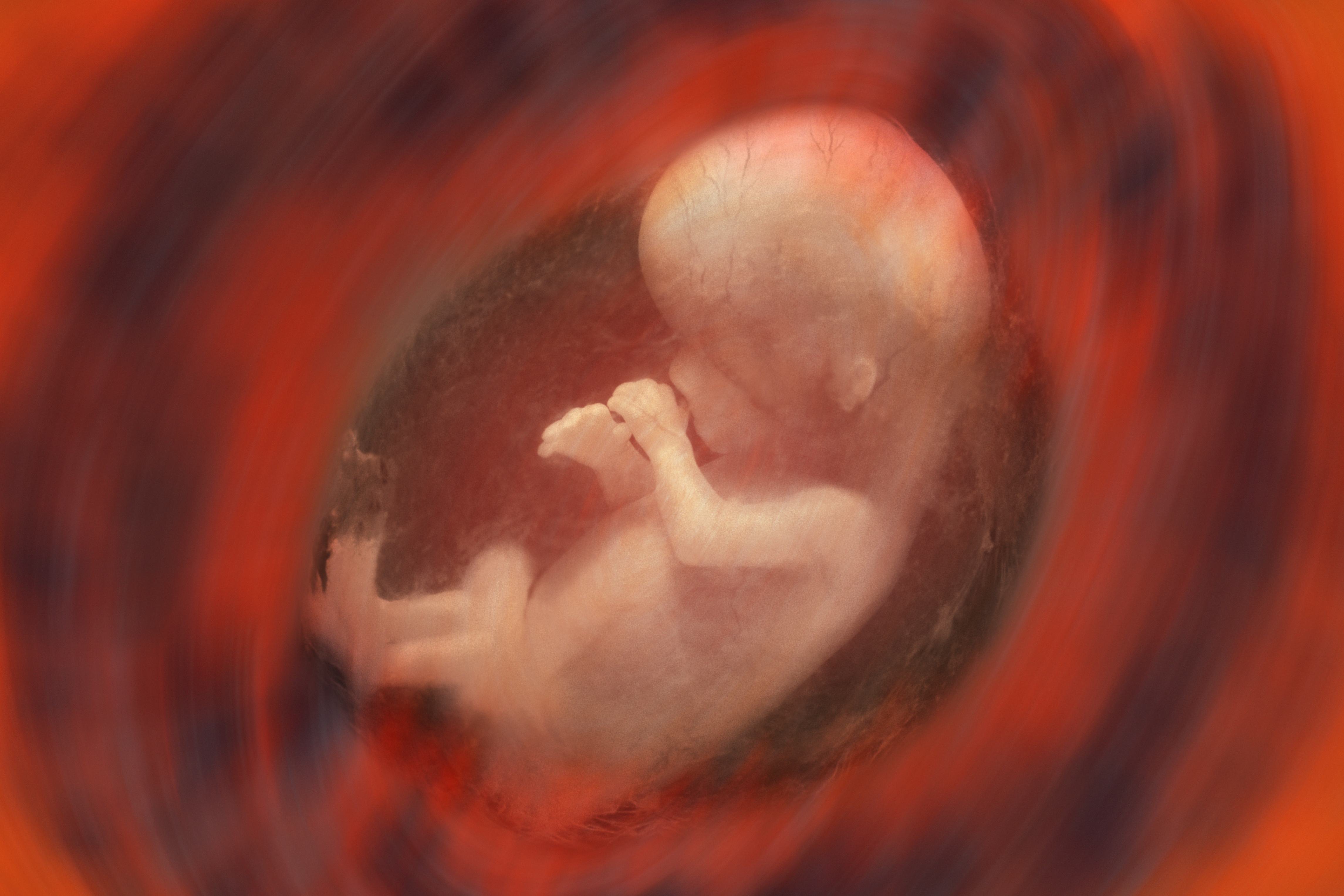 De dubbele agenda van de pro-abortuslobby