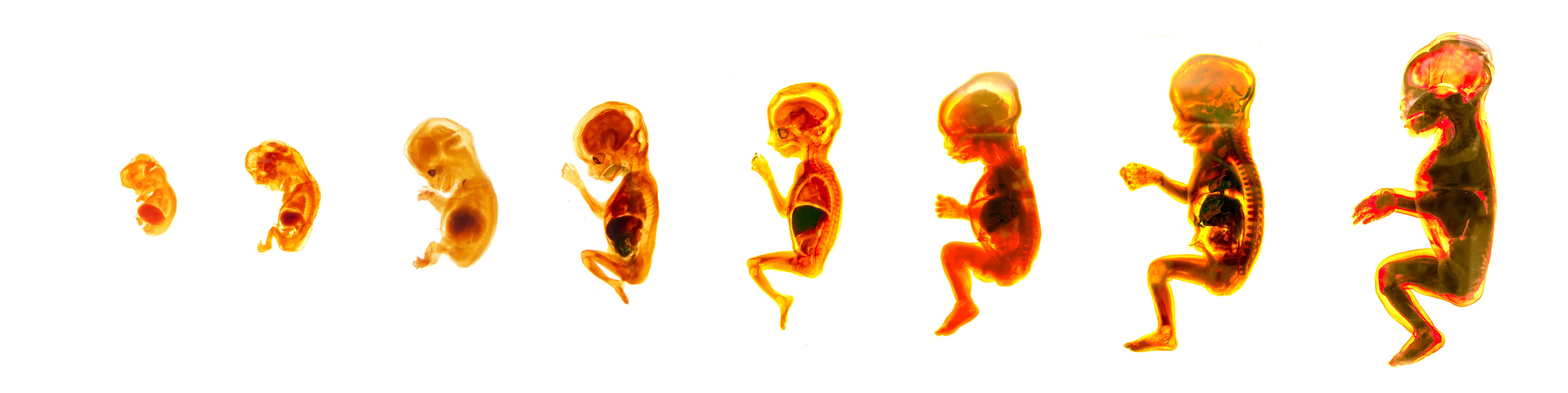 De glijdende schaal voorbij: de dreigende verruiming van de embryowet