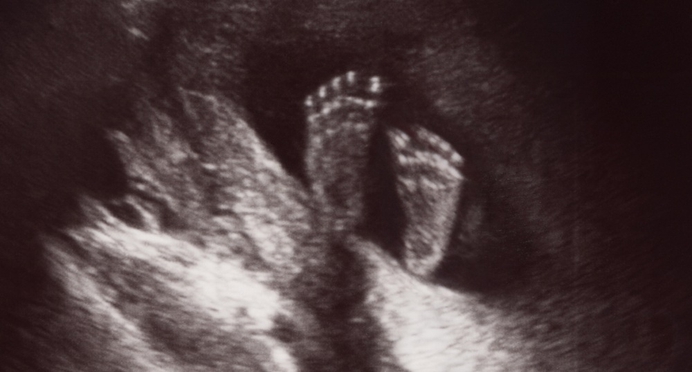 Waarom willen linkse christenen pro-lifers zwartmaken?